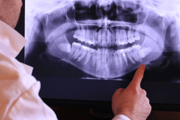 Best Mobile Emergency Dentist in Goulds, FL