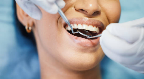 Best Emergency Dentist for Knocked-Out Tooth in Goulds, FL
